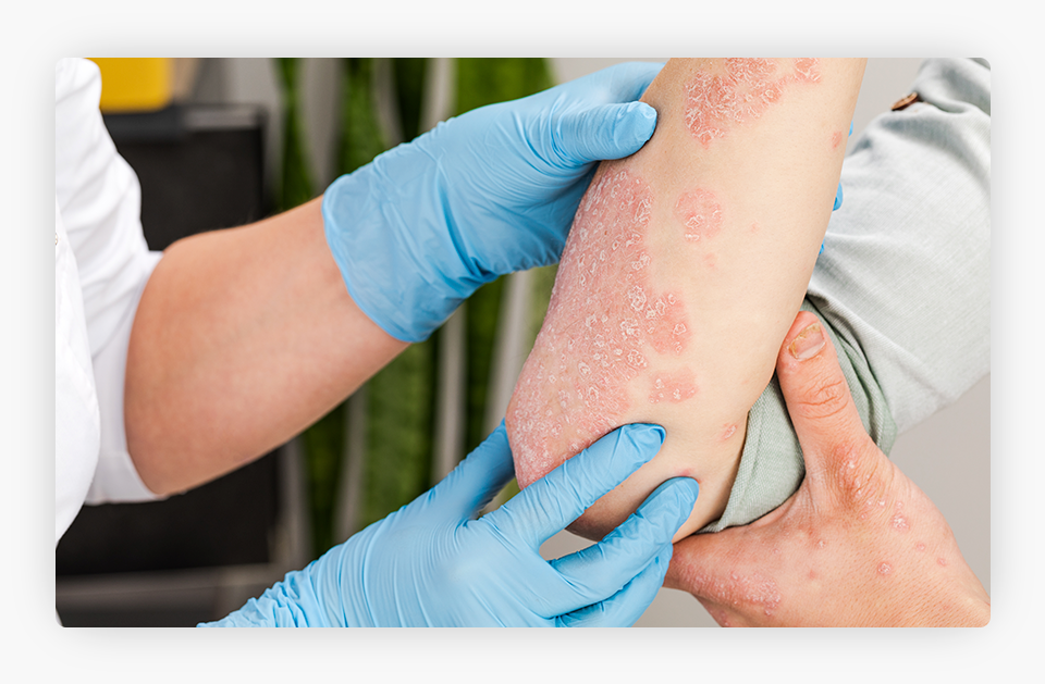 Dermatologist Checking an Injured Patient